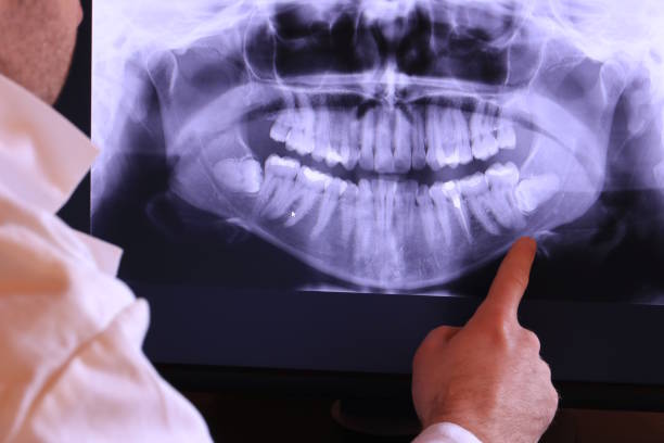 Best Urgent Tooth Repair  in Orange, VA
